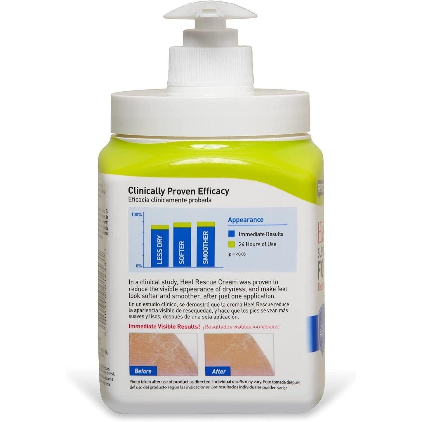 Profoot Heel Rescue Foot Cream