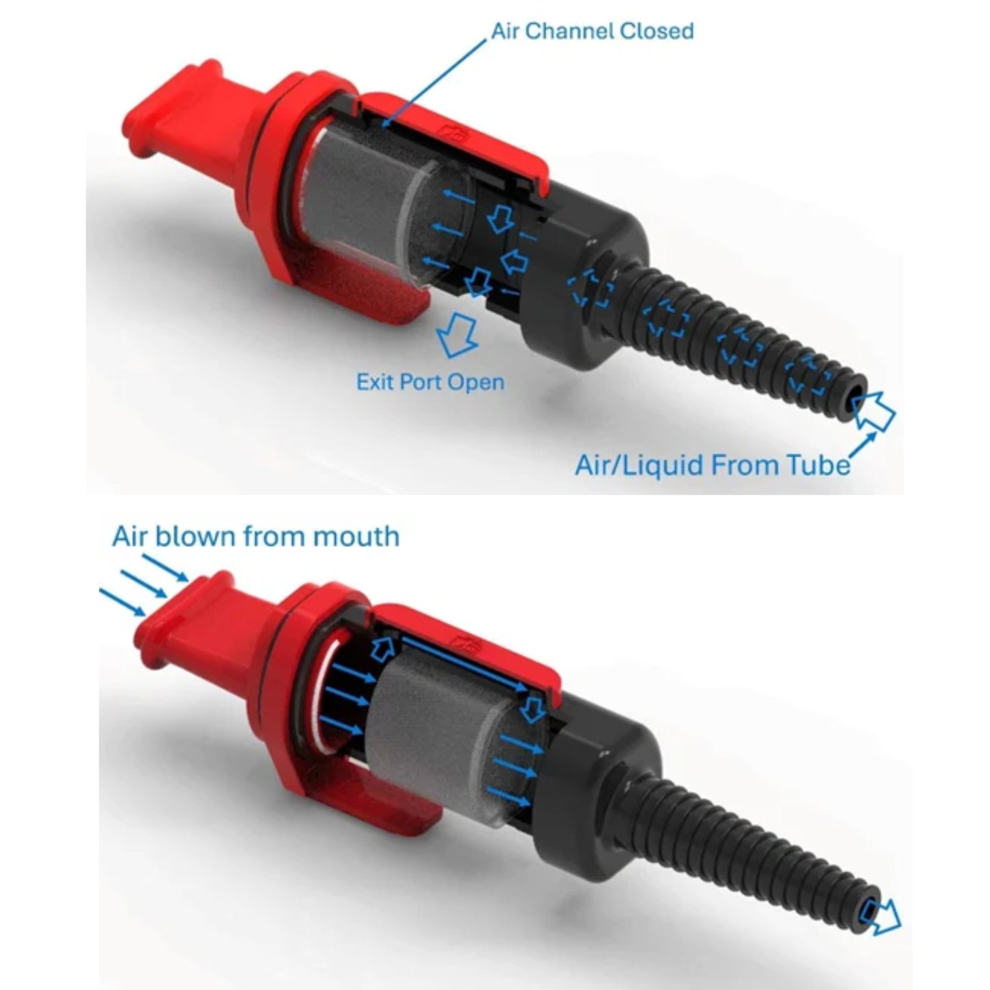 Gastric Tube Device NGT+ 1 Unit - additional product view 3
