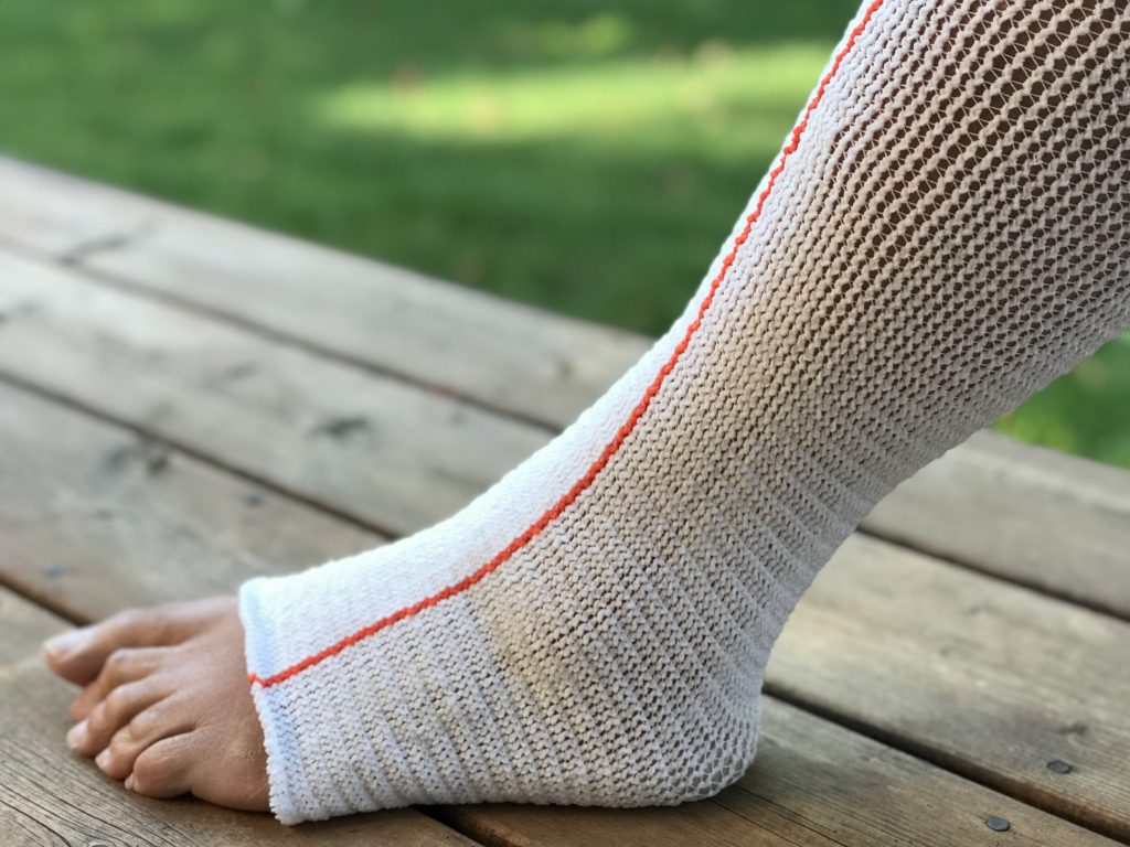Compression Dynamics Edemawear Lite Lymphedema Stockinet Medium Max Limb 90cm Length 86cm For Tender Skin (Orange) CAL096034 — Each — product image