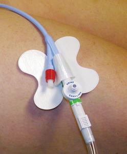 M.C. Johnson Cath-Secure Multi-Purpose Tube Holder 2 1/2in Wrap Tab, Butterfly Base - Each