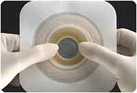 Convatec Natura Moldable Durahesive, Flange 2 3/4in (70mm), Cut-To-Fit 1-5/16in (33mm) - 1 3/4in (45mm) 421041 — Box of 10 — product image